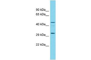 Host:  Rabbit  Target Name:  RGD1305007  Sample Type:  Rat Testis lysates  Antibody Dilution:  1. (OGFOD3 anticorps  (N-Term))