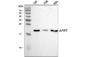 Western blot analysis of APRT using anti-APRT antibody (ABIN4886471). (APRT anticorps  (N-Term))