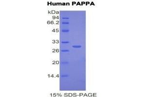 SDS-PAGE (SDS) image for Pregnancy-Associated Plasma Protein A, Pappalysin 1 (PAPPA) (AA 317-532) protein (His tag) (ABIN1171177) (PAPPA Protein (AA 317-532) (His tag))