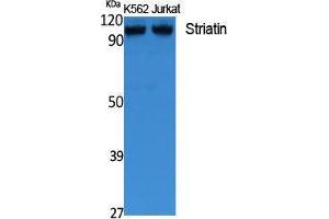 Western Blotting (WB) image for anti-Striatin (STRN) (C-Term) antibody (ABIN3178123) (Striatin anticorps  (C-Term))