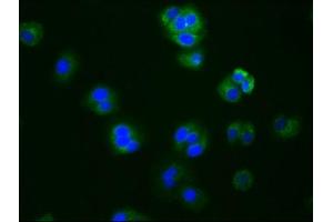 Immunofluorescence staining of HepG2 cells with ABIN7127445 at 1:76, counter-stained with DAPI. (Recombinant Aromatase anticorps)