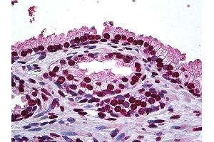 Anti-DLX2 antibody IHC of human prostate.
