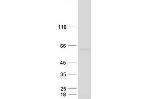 Validation with Western Blot