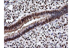 Image no. 9 for anti-EPM2A (Laforin) Interacting Protein 1 (EPM2AIP1) antibody (ABIN1498046) (EPM2AIP1 anticorps)