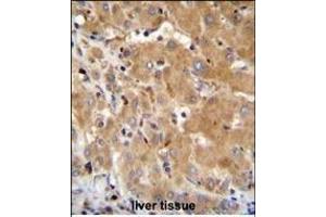 GGH Antibody (N-term) (ABIN655183 and ABIN2844798) immunohistochemistry analysis in formalin fixed and paraffin embedded human liver tissue followed by peroxidase conjugation of the secondary antibody and DAB staining. (GGH anticorps  (N-Term))