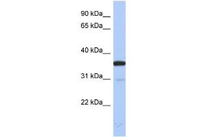 WB Suggested Anti-ESD Antibody Titration: 0. (Esterase D anticorps  (N-Term))