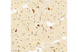Immunohistochemistry of paraffin embedded human brain using Efnb3 (ABIN7073845) at dilution of 1: 600 (250x lens)