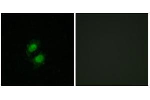 Immunofluorescence analysis of A549 cells, using ZNF95 antibody. (ZNF95 anticorps  (Internal Region))