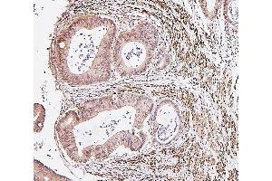 IHC analysis of IRF3 using anti-IRF3 antibody (ABIN7601885).