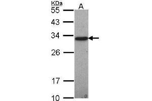 WB Image Sample (30 ug of whole cell lysate) A: Hep G2 , 12% SDS PAGE antibody diluted at 1:1000 (GSTO1 anticorps)