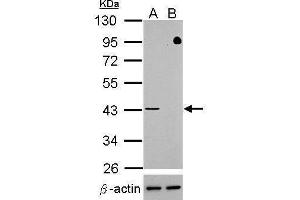 WB Image Western blot analysis of TDP-43 (, upper panel) and beta-actin , lower panel)  Sample (30 ug of whole cell lysate)   A: HeLa mock control  B: HeLa transfected shTDP-43 10% SDS PAGE  antibody diluted at 1:500 (TARDBP anticorps)