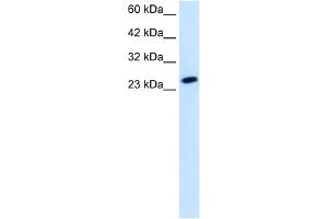 WB Suggested Anti-TBPL1 Antibody Titration:  1. (TBPL1 anticorps  (Middle Region))
