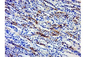 Paraformaldehyde-fixed, paraffin embedded rat kidney, Antigen retrieval by boiling in sodium citrate buffer (pH6) for 15min, Block endogenous peroxidase by 3% hydrogen peroxide for 30 minutes, Blocking buffer (normal goat serum) at 37°C for 20min, Antibody incubation with 	BPTF/FALZ Polyclonal Antibody, Unconjugated  at 1:500 overnight at 4°C, followed by a conjugated secondary and DAB staining.