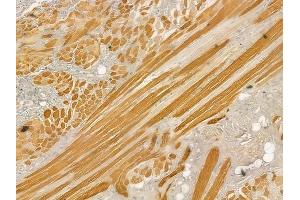 ABIN6257189 and ABIN6273408 at 1/100 staining human tongue carcinoma by IHC-P. (TNNT3 anticorps  (C-Term))