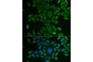 Immunofluorescence analysis of U2OS cells using CCBL1 Polyclonal Antibody (CCBL1 anticorps)