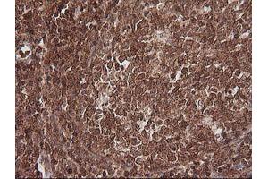 Image no. 6 for anti-Melanoma Antigen Family A, 4 (MAGEA4) antibody (ABIN1499260) (MAGEA4 anticorps)