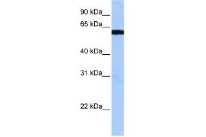 WB Suggested Anti-RBM14 Antibody Titration:  0.