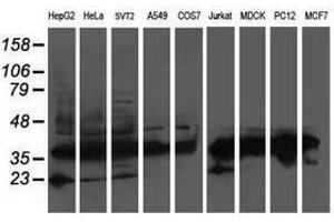 Image no. 3 for anti-ATG3 Autophagy Related 3 (ATG3) antibody (ABIN1496762)