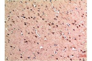 Immunohistochemical analysis of paraffin-embedded Human Brain Tissue using Beclin-1 Mouse mAb diluted at 1:200.
