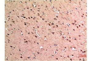 Immunohistochemical analysis of paraffin-embedded Human Brain Tissue using Beclin-1 Mouse mAb diluted at 1:200. (Beclin 1 anticorps)