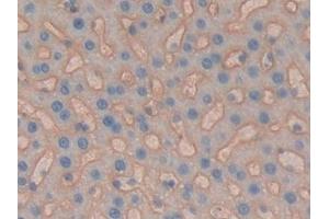 Detection of CD147 in Rat Liver Tissue using Polyclonal Antibody to Cluster Of Differentiation 147 (CD147)