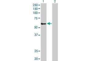 Western Blot analysis of FGFR1OP expression in transfected 293T cell line by FGFR1OP MaxPab polyclonal antibody. (FGFR1OP anticorps  (AA 1-399))
