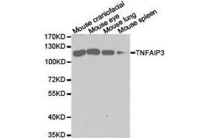 Western Blotting (WB) image for anti-Tumor Necrosis Factor, alpha-Induced Protein 3 (TNFAIP3) antibody (ABIN1875125) (TNFAIP3 anticorps)