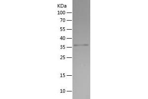 Western Blotting (WB) image for Doublecortin (DCX) (AA 107-208) protein (His-IF2DI Tag) (ABIN7122702)