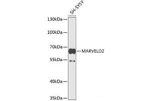 Western blot analysis of extracts of SH-SY5Y cells using MARVELD2 Polyclonal Antibody at dilution of 1:1000. (Tricellulin anticorps)