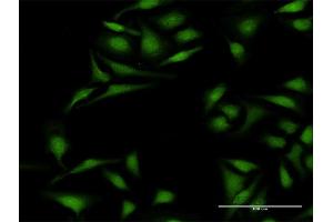 Immunofluorescence of purified MaxPab antibody to KRT12 on HeLa cell.