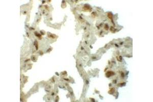 Immunohistochemistry (IHC) image for anti-Transmembrane 4 L Six Family Member 1 (TM4SF1) (N-Term) antibody (ABIN1031625) (TM4SF1 anticorps  (N-Term))