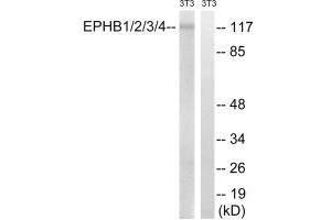 Western blot analysis of extracts from 3T3 cells, treated with heat shock, using EPHB1/2/3/4 (Ab-600/602/614/596) antibody. (Ephb1+Ephb2+Ephb3+Ephb4 (Tyr596), (Tyr600), (Tyr602), (Tyr614) anticorps)