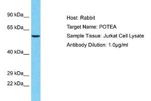 Host: Rabbit Target Name: POTEA Sample Tissue: Human Jurkat Whole Cell Antibody Dilution: 1ug/ml (POTEA anticorps  (C-Term))