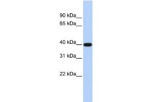 WB Suggested Anti-PAP2D Antibody Titration:  0. (LPPR5 anticorps  (N-Term))