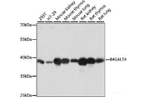 Western blot analysis of extracts of various cell lines using B4GALT4 Polyclonal Antibody at dilution of 1:1000. (B4GALT4 anticorps)