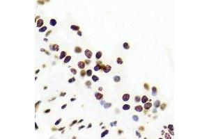 Immunohistochemistry (IHC) image for anti-Upstream Transcription Factor 1 (USF1) antibody (ABIN7308482)