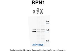 WB Suggested Anti-RPN1 Antibody Titration: 1 µg/mL Positive Control: HeLa and CHO-K1 cell lines, rouch canine microsomes (RPN1 anticorps  (N-Term))