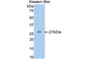 Western Blotting (WB) image for anti-Glutathione S-Transferase mu 2 (Muscle) (GSTM2) (AA 1-218) antibody (ABIN1078085) (GSTM2 anticorps  (AA 1-218))