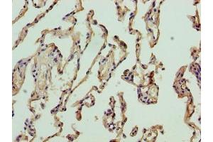 Immunohistochemistry of paraffin-embedded human lung tissue using ABIN7161563 at dilution of 1:100 (NICN1 anticorps  (AA 1-213))