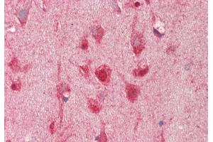 Rabbit Anti-TMEM16K antibody  Formalin Fixed Paraffin Embedded Tissue: Human Brain, Cortex Primary antibody Concentration: 1:200 Secondary Antibody: Donkey anti-Rabbit-Cy3 Secondary Antibody Concentration: 1:200 Magnification: 20x Exposure Time: 0. (Anoctamin 10 anticorps  (C-Term))