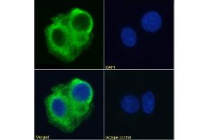 Immunofluorescence staining of HepG2 cells using anti-DR5 antibody TRA-8.