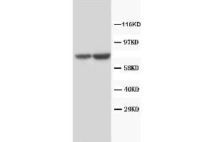Lane 1: Rat Ovary Tissue LysateLane 2: Human Placenta Tissue Lysate (FSHR anticorps)