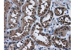 Immunohistochemical staining of paraffin-embedded Kidney tissue using anti-AKR1A1mouse monoclonal antibody. (AKR1A1 anticorps)