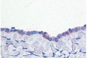 Human Ovary: Formalin-Fixed, Paraffin-Embedded (FFPE) (ENPP3 anticorps  (C-Term))