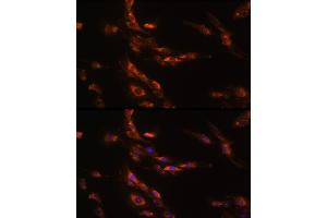 Immunofluorescence analysis of C6 cells using G Rabbit pAb (ABIN7267344) at dilution of 1:100 (40x lens). (GABRg1 anticorps  (AA 200-260))