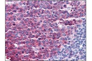 Image no. 3 for anti-Stathmin 1 (STMN1) (C-Term) antibody (ABIN374648) (Stathmin 1 anticorps  (C-Term))