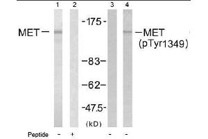 Image no. 1 for anti-Met Proto-Oncogene (MET) (pTyr1349) antibody (ABIN196990) (c-MET anticorps  (pTyr1349))