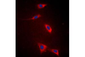 Immunofluorescent analysis of FATP5 staining in HeLa cells. (SLC27A5 anticorps  (Center))