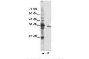 Image no. 2 for anti-Exosome Component 3 (EXOSC3) (AA 81-130) antibody (ABIN6736236) (EXOSC3 anticorps  (AA 81-130))