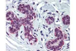 Anti-CREBBP antibody IHC of human breast. (CBP anticorps  (AA 144-193))